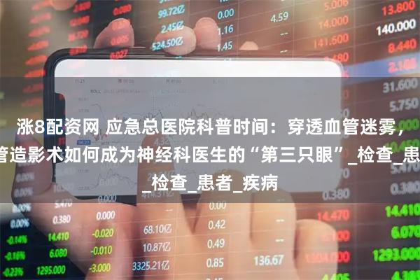 涨8配资网 应急总医院科普时间：穿透血管迷雾，全脑血管造影术如何成为神经科医生的“第三只眼”_检查_患者_疾病